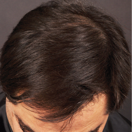 Welcome Hair 2 nachher
