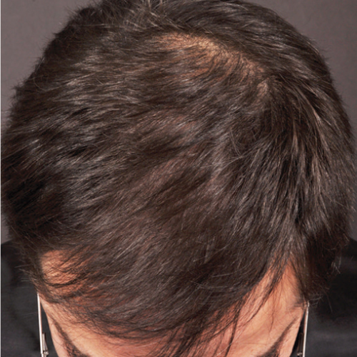 Welcome Hair 2 vorher