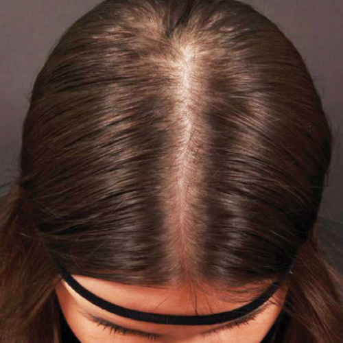 Welcome Hair Woman nachher